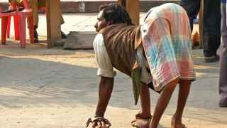 Без прививки дети болеют полиомиелитом. Видели человека, перенесшего полиомиелит? Посмотрите